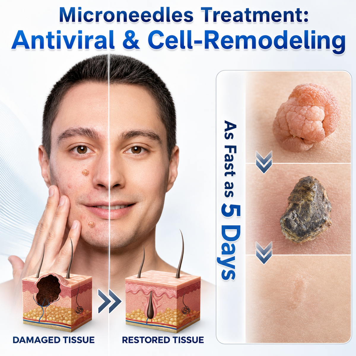 🌿Botanical Microneedle Hydrocolloid Patches — Targeted At-Home Skincare for Small Areas of Concern | For Moles, Acne, Flat Warts, Skin Tags, Wrinkles, Scars & Blemishes| Devareon®