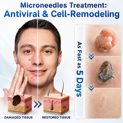 🌿Botanical Microneedle Hydrocolloid Patches — Targeted At-Home Skincare for Small Areas of Concern | For Moles, Acne, Flat Warts, Skin Tags, Wrinkles, Scars & Blemishes| Devareon®