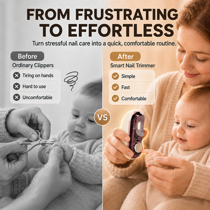 upsell✨40% OFF! 👶 Smart Electric Nail Clipper — Gentle & Safe Nail Care for Baby’s Tiny Fingers & The Whole Family ✨ — Devareon®