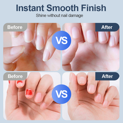 upsell 60%Universal Automatic Fingernail Grinder for Adults and Children -Devareon®