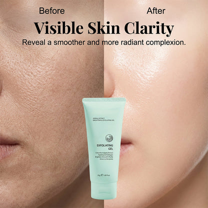 Devareon®🥳2026 HOT SALE🥳💞50K+ SOLD!💥👵🌸 40% OFF!Herbal Extract Brightening Exfoliating Gel