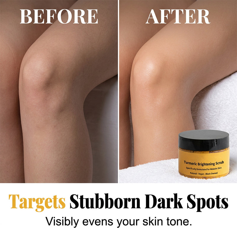 Devareon® 🥳🔥BUY 2 GET 1 FREE🔥Turmeric Exfoliating Body Scrub