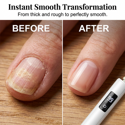 🥳2026 HOT SALE💅50% OFF! Professional Electric Nail Polisher – Smooths thick nails, Multiple heads for shaping & buffing---Devareon®