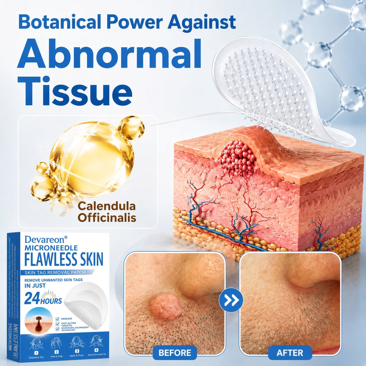 🌿Botanical Microneedle Hydrocolloid Patches — Targeted At-Home Skincare for Small Areas of Concern | For Moles, Acne, Flat Warts, Skin Tags, Wrinkles, Scars & Blemishes| Devareon®
